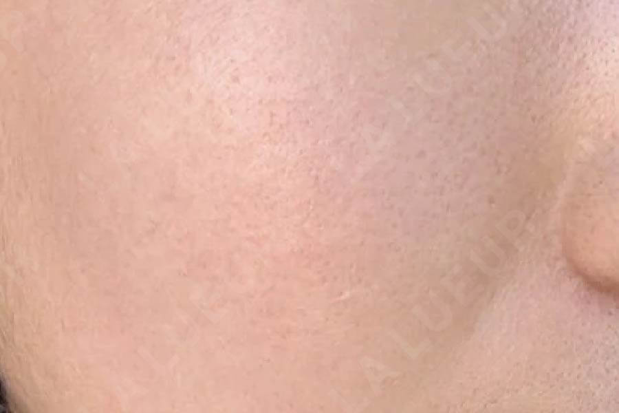 After Image