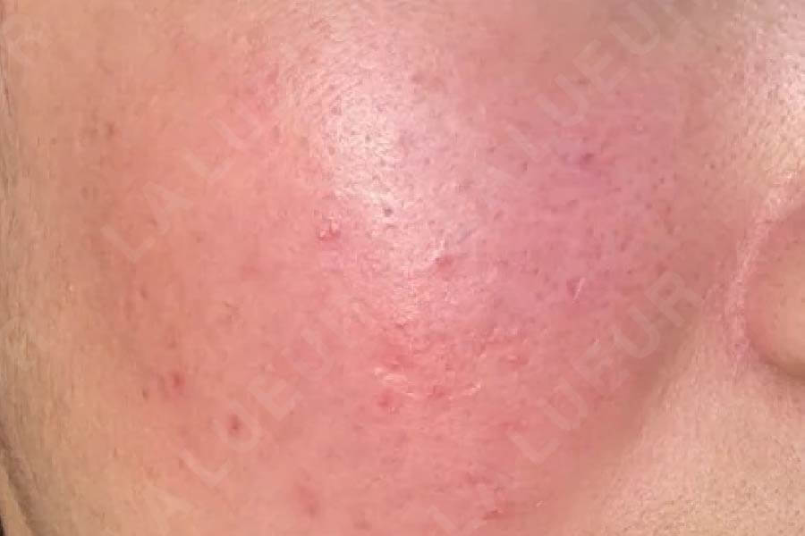 Before Image