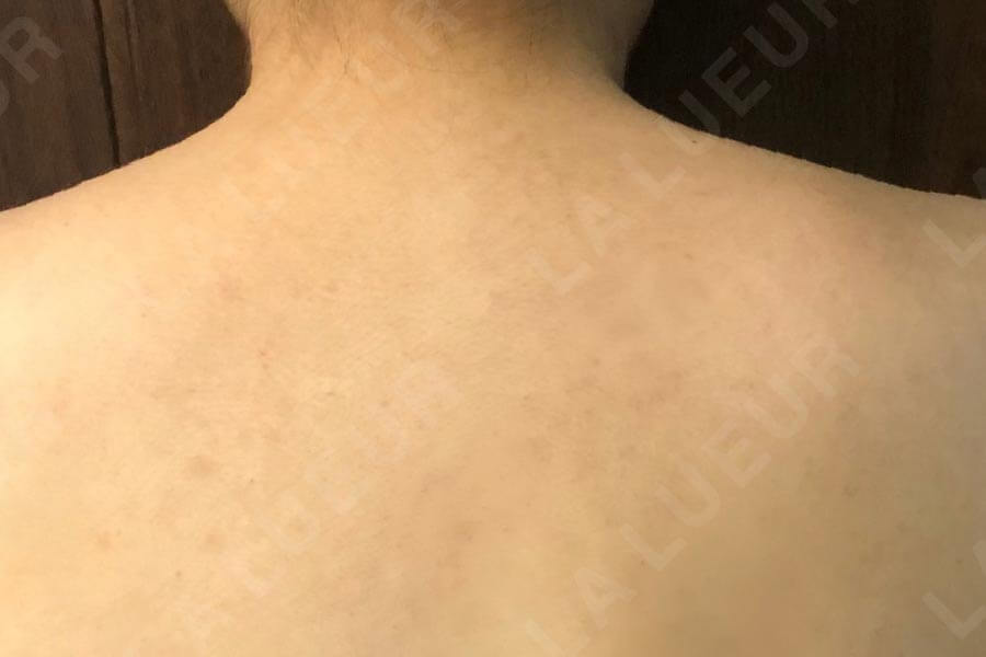 After Image