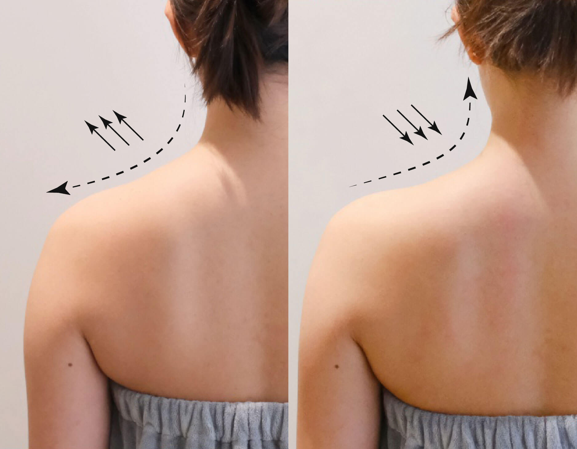 案例分享-小香肩-Katie