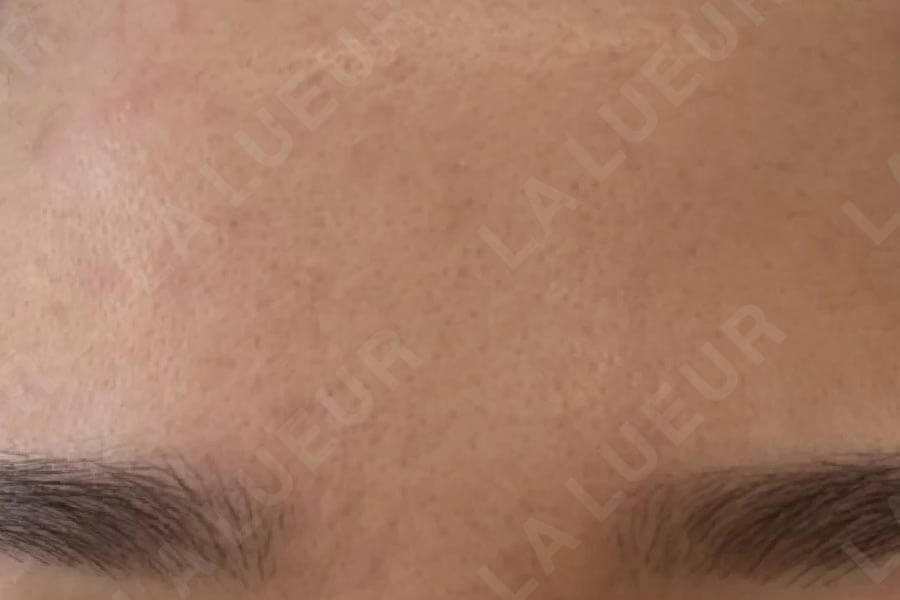 After Image
