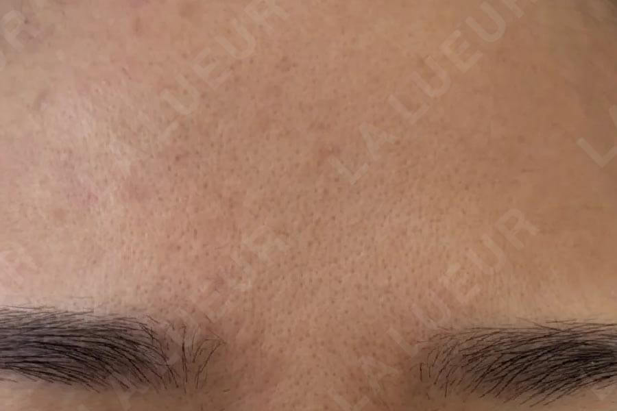 Before Image