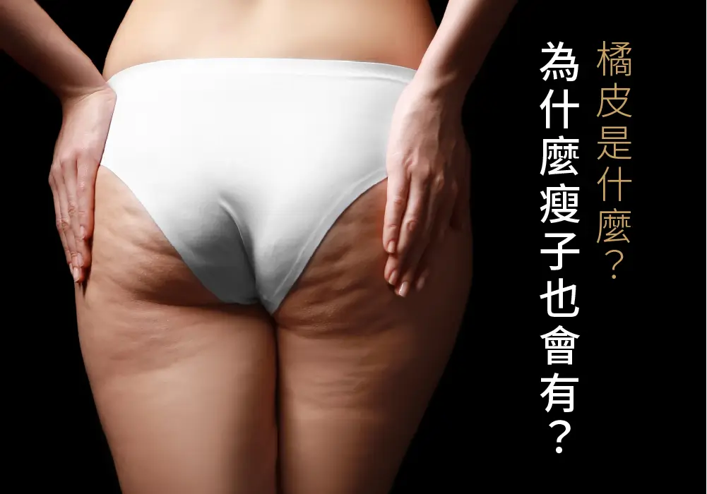 美學新知-橘皮怎麼消