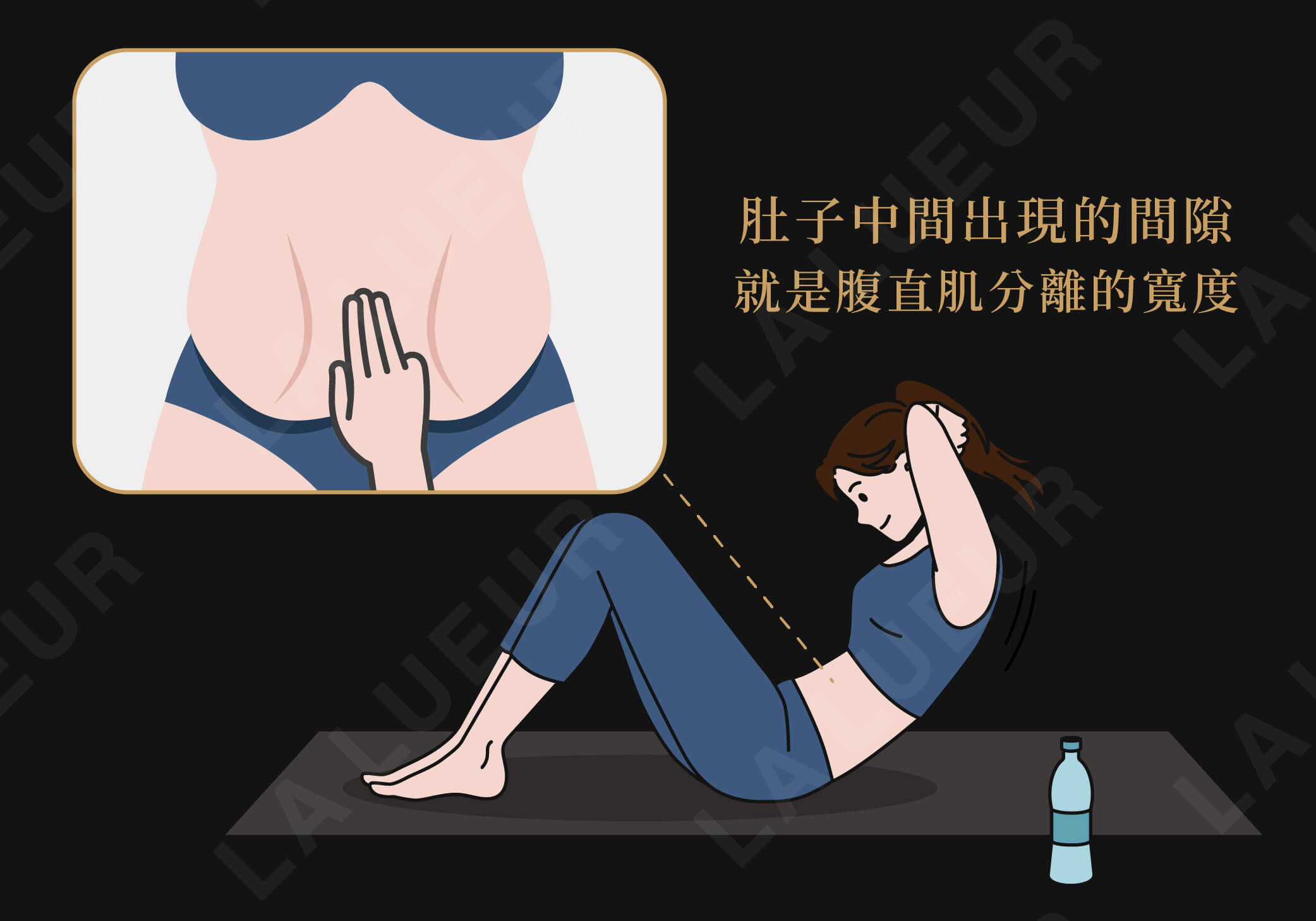 美學新知-產後肚皮鬆弛